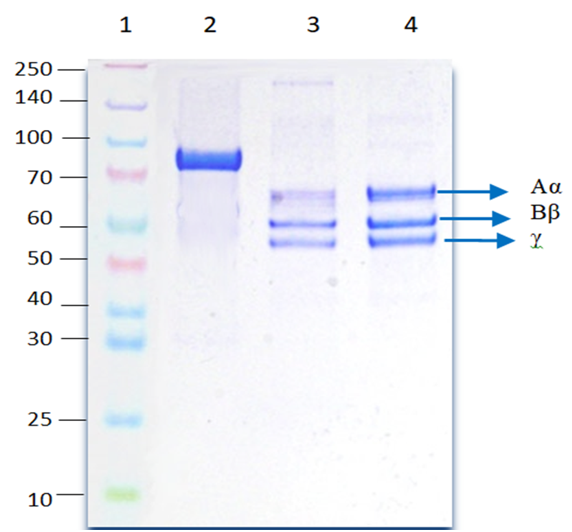 Figura 1.
Electroforesis SDS- PAGE: gel al 8% en condiciones reductoras. Carril 1.
Marcadores de peso molecular (kDa). Carril 2. Plasminógeno eliminado
de la preparación de Fg. Carril 3. Fg comercial.
Carril 4. Fg purificado por β-alanina.