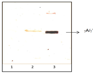 Figura 3. Inmunoelectroforesis de las dos poblaciones de
Fg purificado por FPLC γA/γA y γA/γ’. Las
muestras fueron analizadas en condiciones reductoras, utilizando el anticuerpo
2.G2.H9, monoclonal de ratón dirigido contra la cadena γ´ humana. Revelado con 3,3′,
5,5′-Tetrametilbenzidina (TMB) y peróxido de hidrógeno. Carril 1, pico 1 de Fg.
Carril 2, pico 2 del Fg purificado. Carril 3. Fg γA/γ’ comercial.