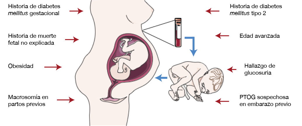 Analisis de diabetes online gestacional