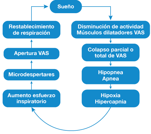 Apnea del sueño: Síndrome de apnea-hipoapnea del sueño (SAHS)